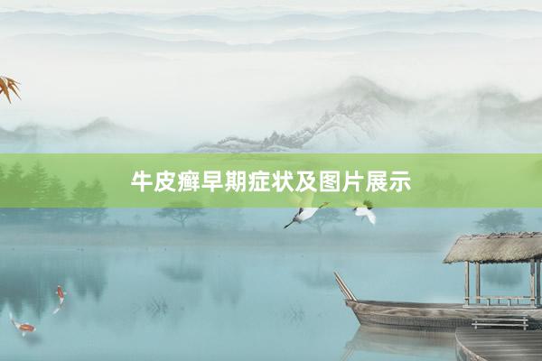 牛皮癣早期症状及图片展示
